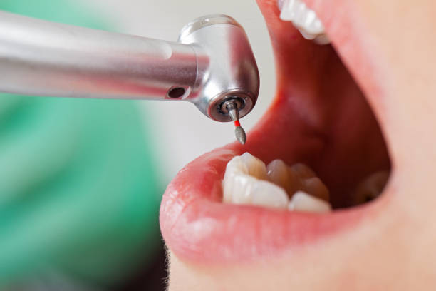 Best Knocked-Out Tooth Emergency  in Pinetops, NC